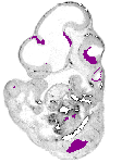 mouse atlas EMAGE spatial in situ gene expression database None