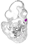 mouse atlas EMAGE spatial in situ gene expression database None