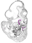 mouse atlas EMAGE spatial in situ gene expression database None