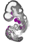 mouse atlas EMAGE spatial in situ gene expression database None