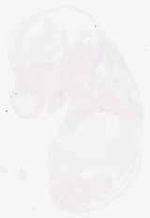 EMAGE:6204
