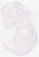 EMAGE:6241