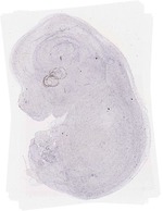 EMAGE:6241