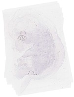 EMAGE:6266