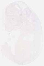 EMAGE:6316