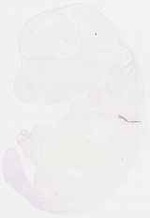 EMAGE:6321