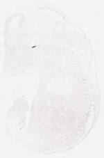 EMAGE:6417
