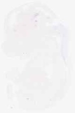 EMAGE:6435