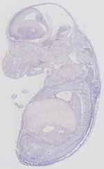 EMAGE:6474