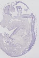EMAGE:6474
