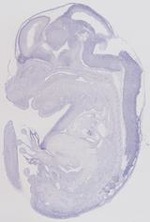EMAGE:6474