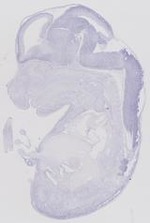 EMAGE:6474