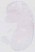 EMAGE:6506