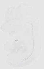 EMAGE:6526