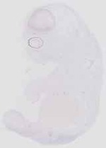 EMAGE:6573