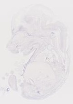 EMAGE:6737