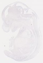 EMAGE:6761