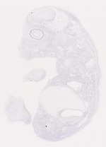 EMAGE:6792