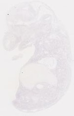 EMAGE:6792