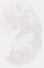 EMAGE:6792