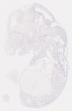 EMAGE:6792