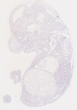 EMAGE:6792