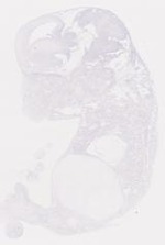 EMAGE:6792