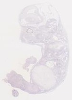 EMAGE:6792