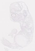 EMAGE:6792