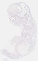 EMAGE:6792