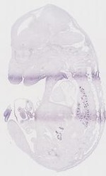 EMAGE:6796