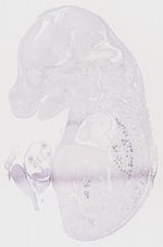 EMAGE:6796