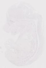 EMAGE:6814
