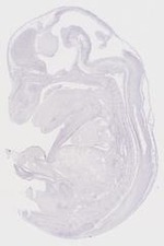 EMAGE:6835