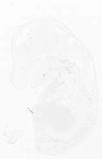 EMAGE:6861