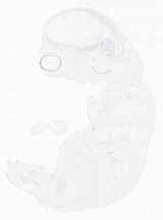 EMAGE:6972