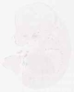 EMAGE:6973