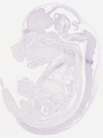 EMAGE:7146