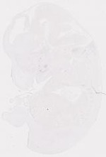EMAGE:7256