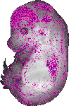 mouse atlas EMAGE spatial in situ gene expression database None