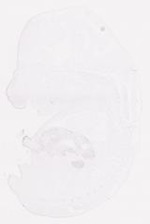 EMAGE:7819
