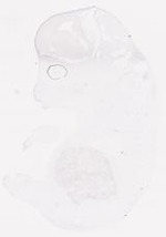 EMAGE:7819