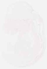 EMAGE:7952