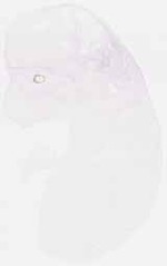 EMAGE:8098