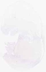 EMAGE:8162