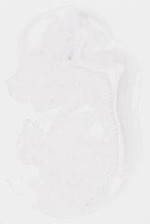 EMAGE:8451
