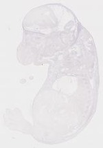EMAGE:8451