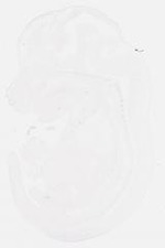 EMAGE:8454