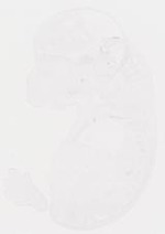 EMAGE:8455