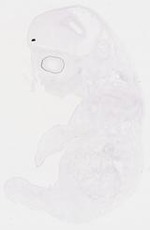 EMAGE:8461
